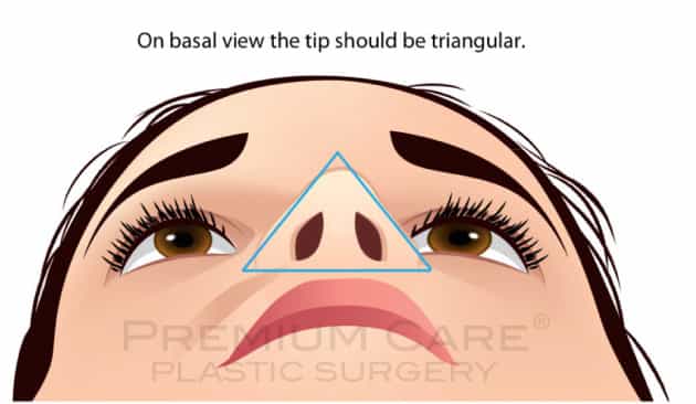 Rhinoplasty in Colombia