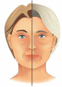 Neck Lift in Colombia -Premium Care Medical Suites