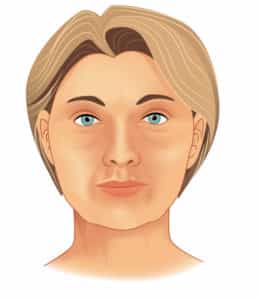 Neck Lift in Colombia - Premium-Care-Plastic-Surgery