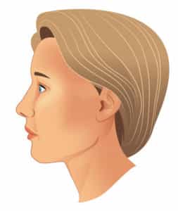 Neck Lift in Colombia - Premium Care Plastic Surgery