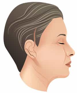 Neck Lift in Colombia - Neck-Lift-Premium Care Plastic Surgery