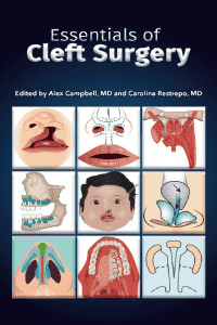 essentials of cleft surgery