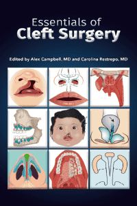essentials of cleft surgery essentials of cleft surgery