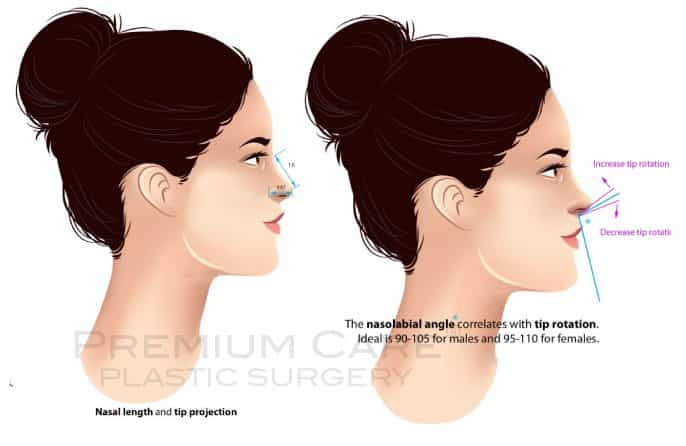 Rhinoplasty in Colombia - Premium Care Plastic Surgery