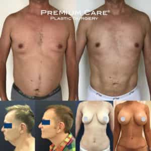 Plastic Surgeons Colombia - Premium Care Plastic Surgery Best Plastic Surgeons Colombia - Premium Care Plastic Surgery