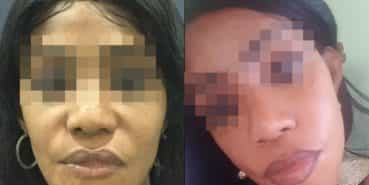 facelift colombia 211 - 3-min
